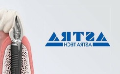 Импланты