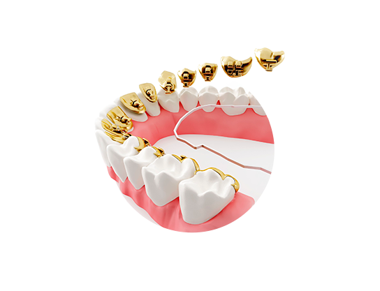 braces image
