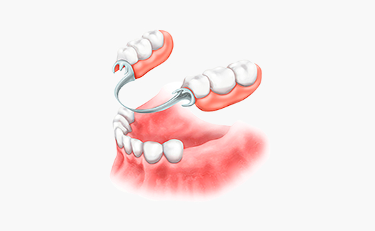 protez-zubov image