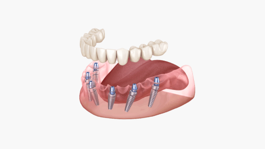 protez-zubov image