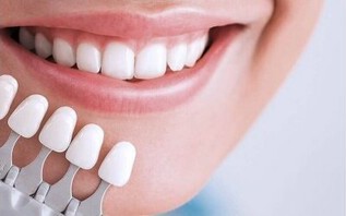 Импланты Mis