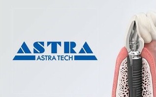 Импланты Astra